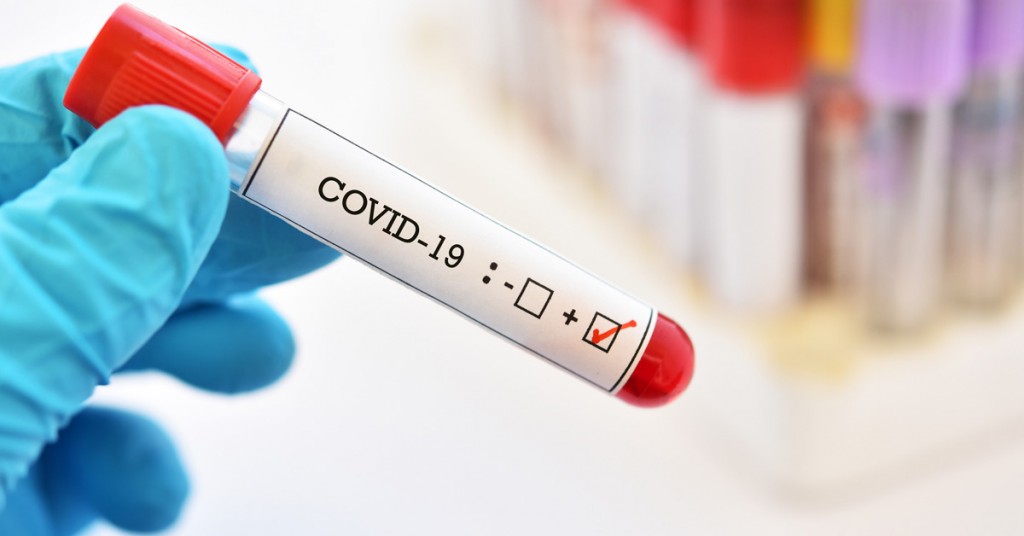 Nueva marca de casos: 27.001 personas fueron reportadas con coronavirus