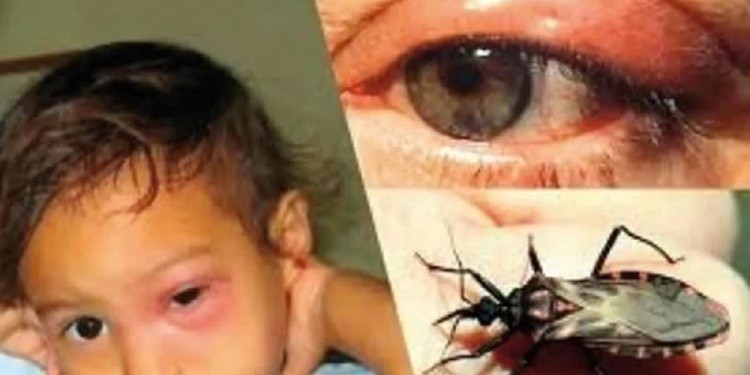 Mal de Chagas: qué es, cómo afecta y cómo prevenirlo