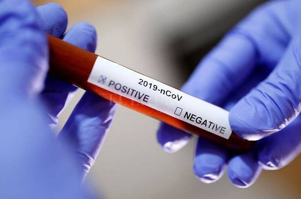 Chaco: Salud informó 27 nuevos casos y suman 507 positivos de coronavirus en la provincia