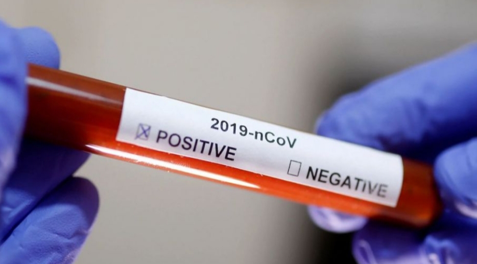 Chaco: Salud confirmó 21 nuevos casos positivos de coronavirus; suman 788 en la provincia
