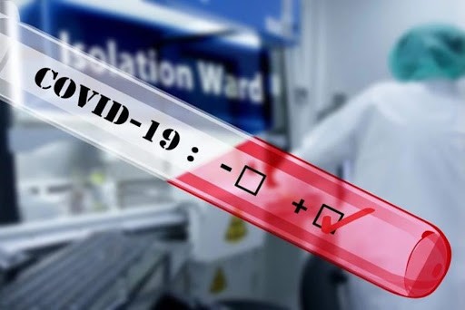 Chaco: Salud confirmó 31 nuevos casos positivos de coronavirus; suman 819 en la provincia