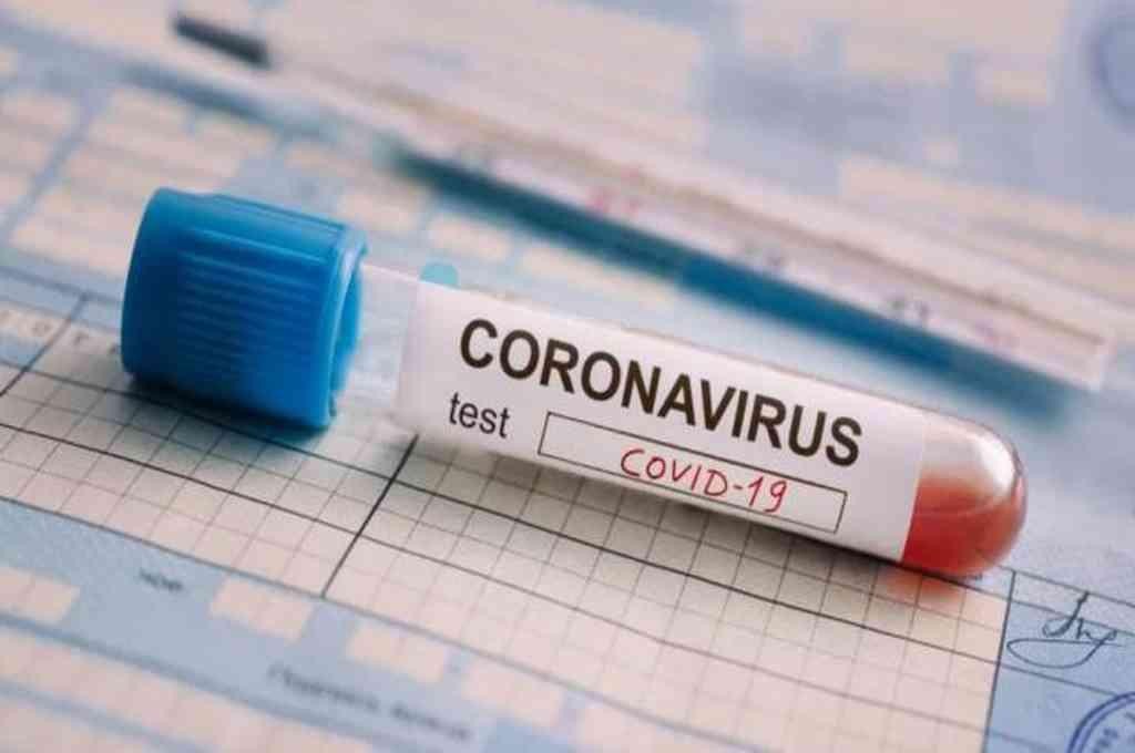 Chaco: Salud confirmó 9 nuevos casos positivos de coronavirus; suman 905 en la provincia