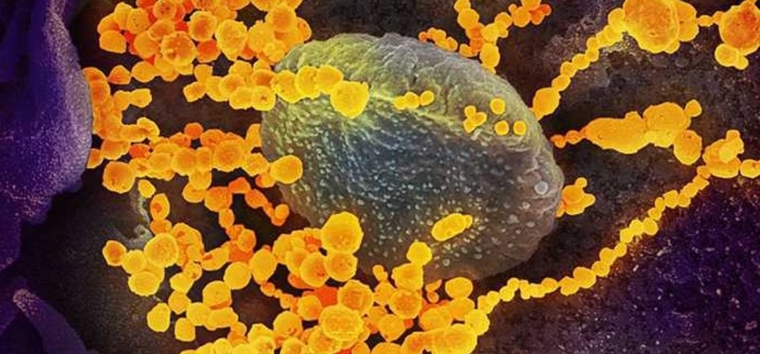 Salud actualizó información: nueva víctima fatal con coronavirus