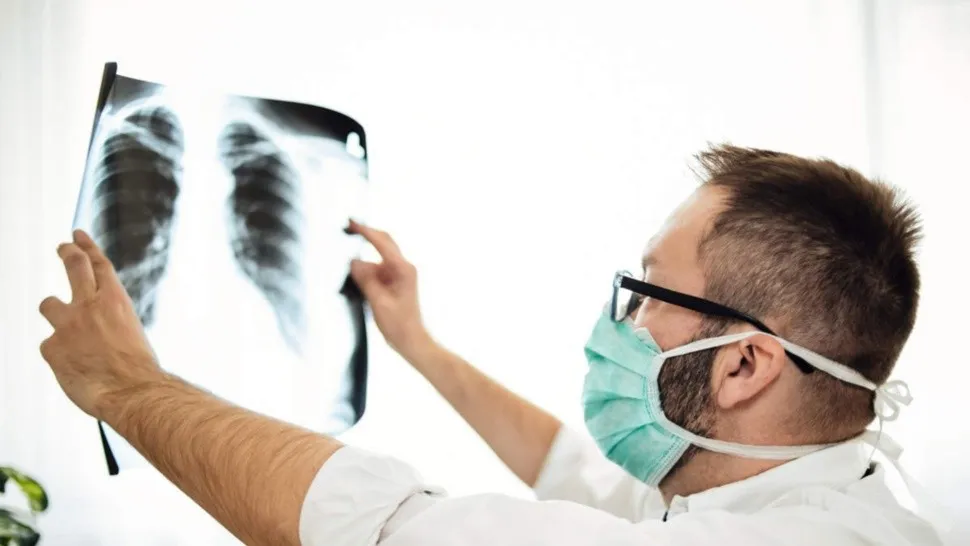 Los pulmones de pacientes recuperados de Covid-19 quedan más dañados que los de un fumador