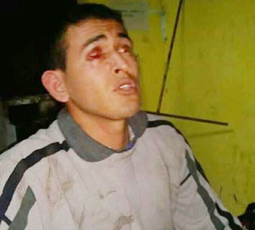 “A mi hijo lo persiguen por portación de apellido desde el 2013, no tiene ni antecedentes”