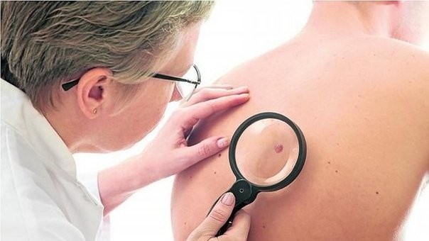 Comenzará mañana la semana de prevención del Cáncer de Piel