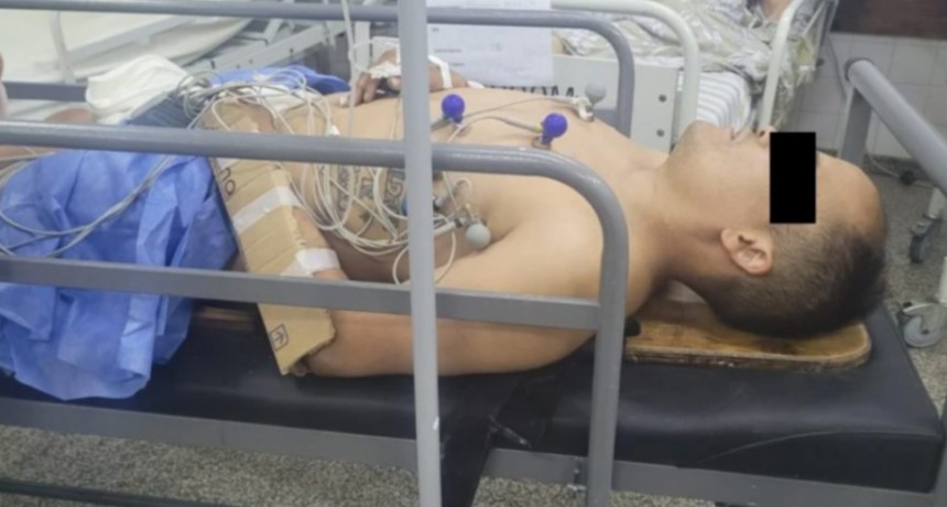 Intentó robarle el auto a una mujer policía en Mar del Plata y la pareja de la oficial le fracturó los dos brazos