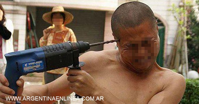 Se quiso suicidar taladrándose el cerebro